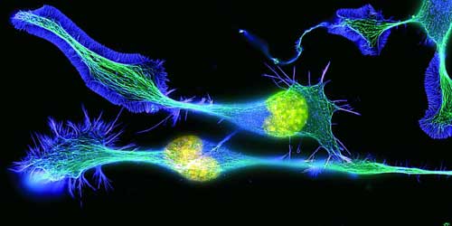 neuronas metabolicas