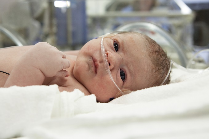 El New England Journal of Medicine (NEJM) anuncia los resultados de un estudio único sobre la enfermedad de Hirschsprung que afecta a los bebés
