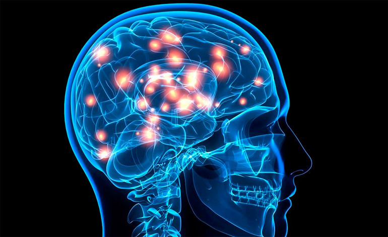 Encefalopatía epiléptica con desmielinización cerebral global