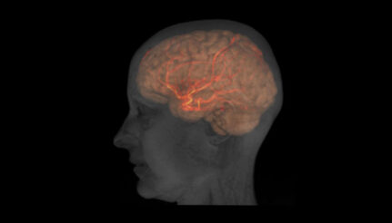 flujo sanguíneo cerebral