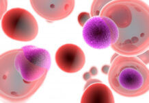 células T, esclerosis múltiple, enfermedades autoinmunes