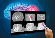 tumor cerebral, investigaciónes_biomédicas