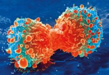 Células inmunitarias promotoras de tumores capacitadas para combatir el tipo de cáncer cerebral más agresivo