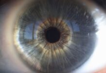 Un nuevo estudio ayuda a comprender las bases moleculares de las distrofias hereditarias de retina causadas por el gen ‘CERKL’
