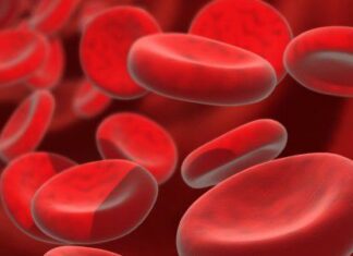 Sea bienvenido Asociación civil de pacientes con hemoglobinuria paroxistica nocturna Asociación civil de pacientes con hemoglobinuria paroxistica nocturna