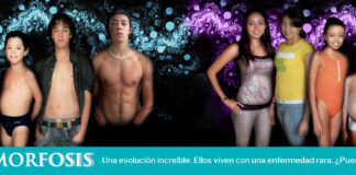 Metamorfosis de personas que viven con una enfermedad rara. Una evolución sorprendente. ¿Puede usted creerlo? Si ellos pudieron, ¿por qué otros no?
