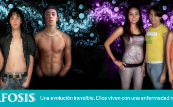 Metamorfosis de personas que viven con una enfermedad rara. Una evolución sorprendente. ¿Puede usted creerlo? Si ellos pudieron, ¿por qué otros no?
