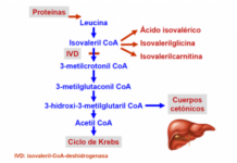acidemia isovalérica