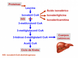 acidemia isovalérica