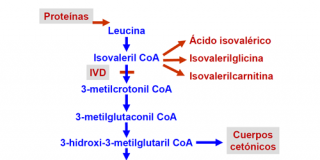 acidemia isovalérica