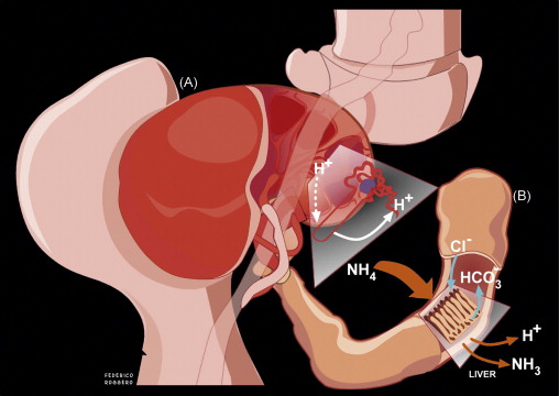 acidosis renal