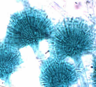 aspergillus