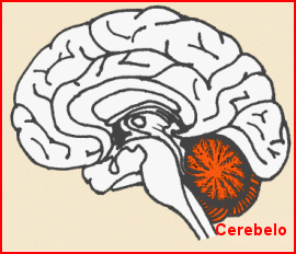 ataxia cerebral