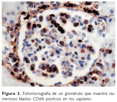 excresion urinaria