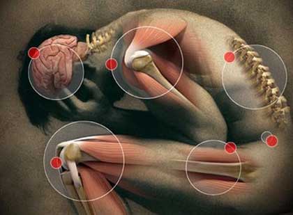 trastorno neuromuscular