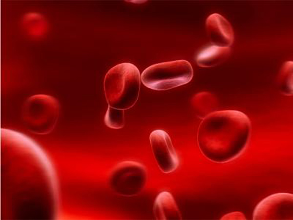 anemia hemolitica