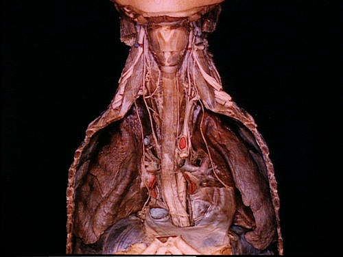 angioedema