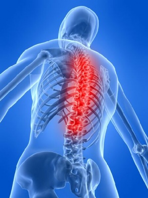 atrofia muscular espinal