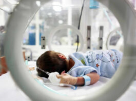 Atrofia muscular espinal proximal tipo 2