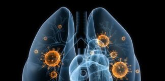Cáncer pulmonar de células pequeñas