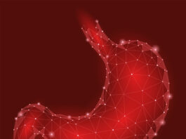 Carcinoma de células escamosas de esófago