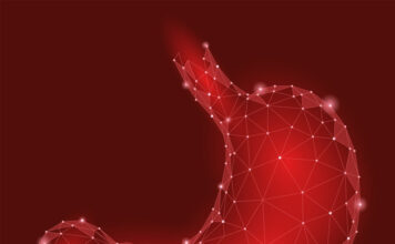 Carcinoma de células escamosas de esófago