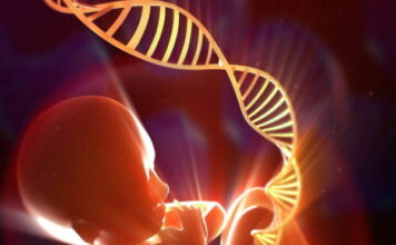 Síndrome de braquidactilia-hallux varus preaxial