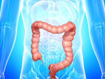 colitis colagenosa