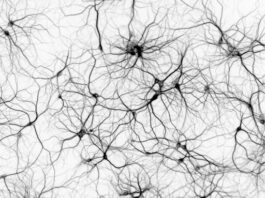 Déficit de la proteína de unión E3 de la piruvato deshidrogenasa
