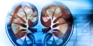 Discondrosteosis nefropatía