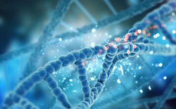 displasia oto-espondilo-megaepifisaria