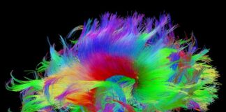 trastorno neurometabólico