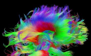 trastorno neurometabólico