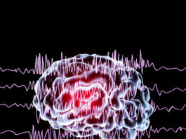 Epilepsia generalizada - discinesia paroxística