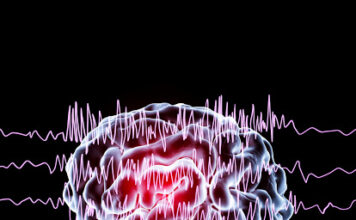 Epilepsia generalizada - discinesia paroxística