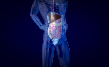 Glomerulopatía inmunotactoide o fibrilar