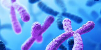 Displasia ectodérmica hipohidrótica