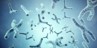 Síndrome de Haim-Munk