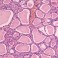 folicular