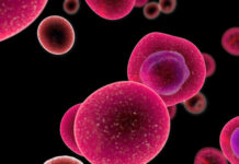 Micosis fungoide