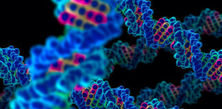 Necrosis estriatal bilateral infantil esporádica