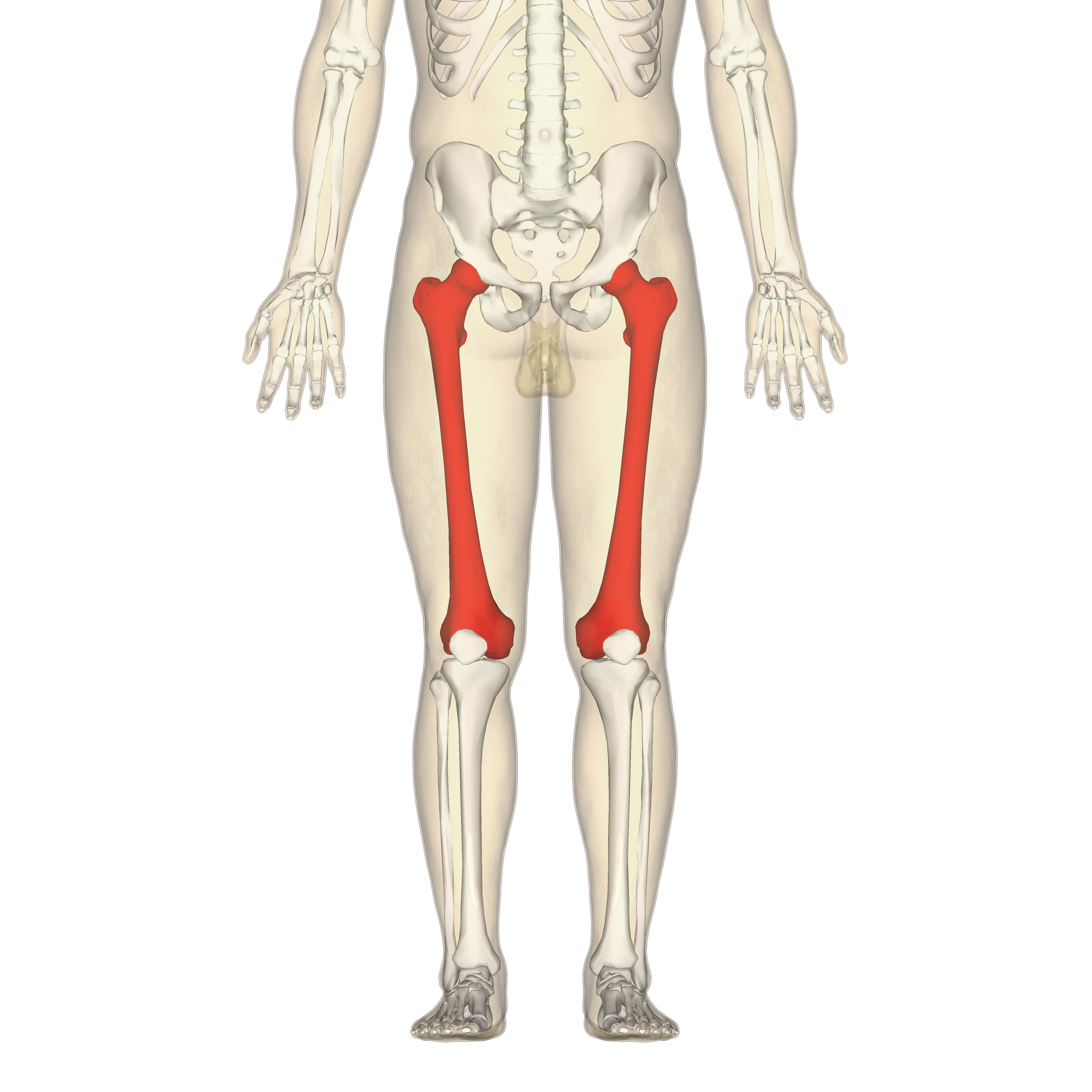 Síndrome angio-osteo-hipertrófico