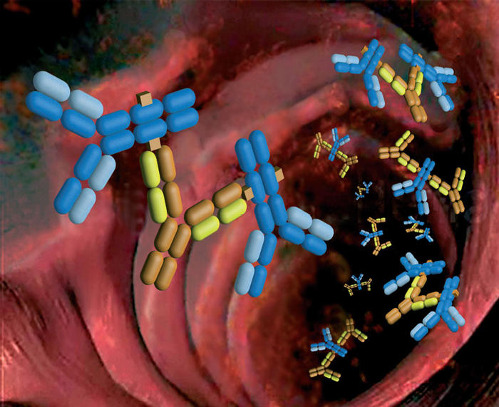 Vasculitis por inmunoglobulina A