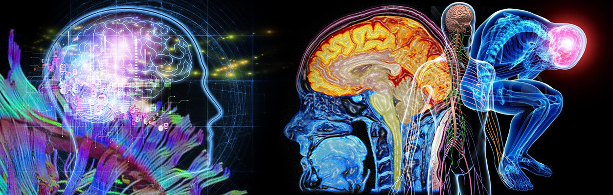 Parálisis supranuclear progresiva - síndrome corticobasal