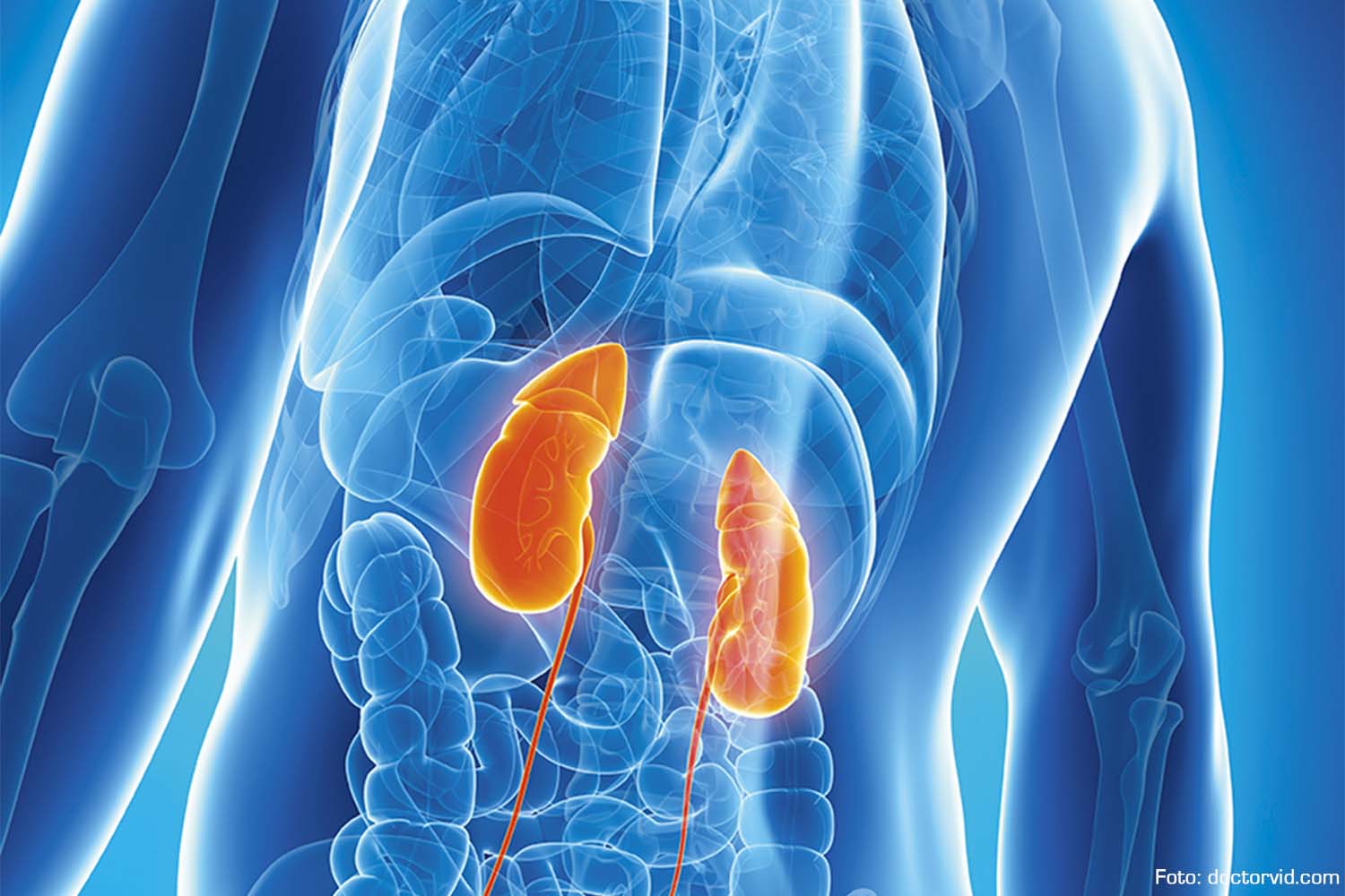 Osteopetrosis Con Acidosis Tubular Renal FEMEXER