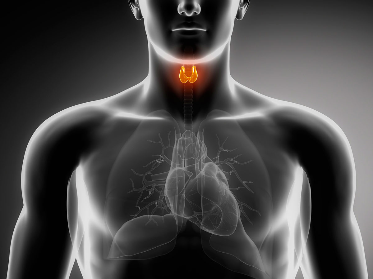 Resistencia periférica a las hormonas tiroideas