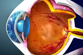 Retinopatía asociada a cancer