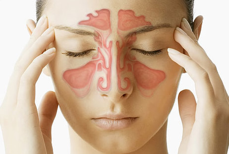 Síndrome de malformación blefaro-naso-facial