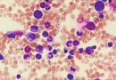 Neutropenia congénita