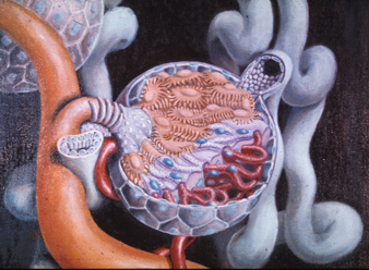 Acidosis tubular renal distal autosómica dominante